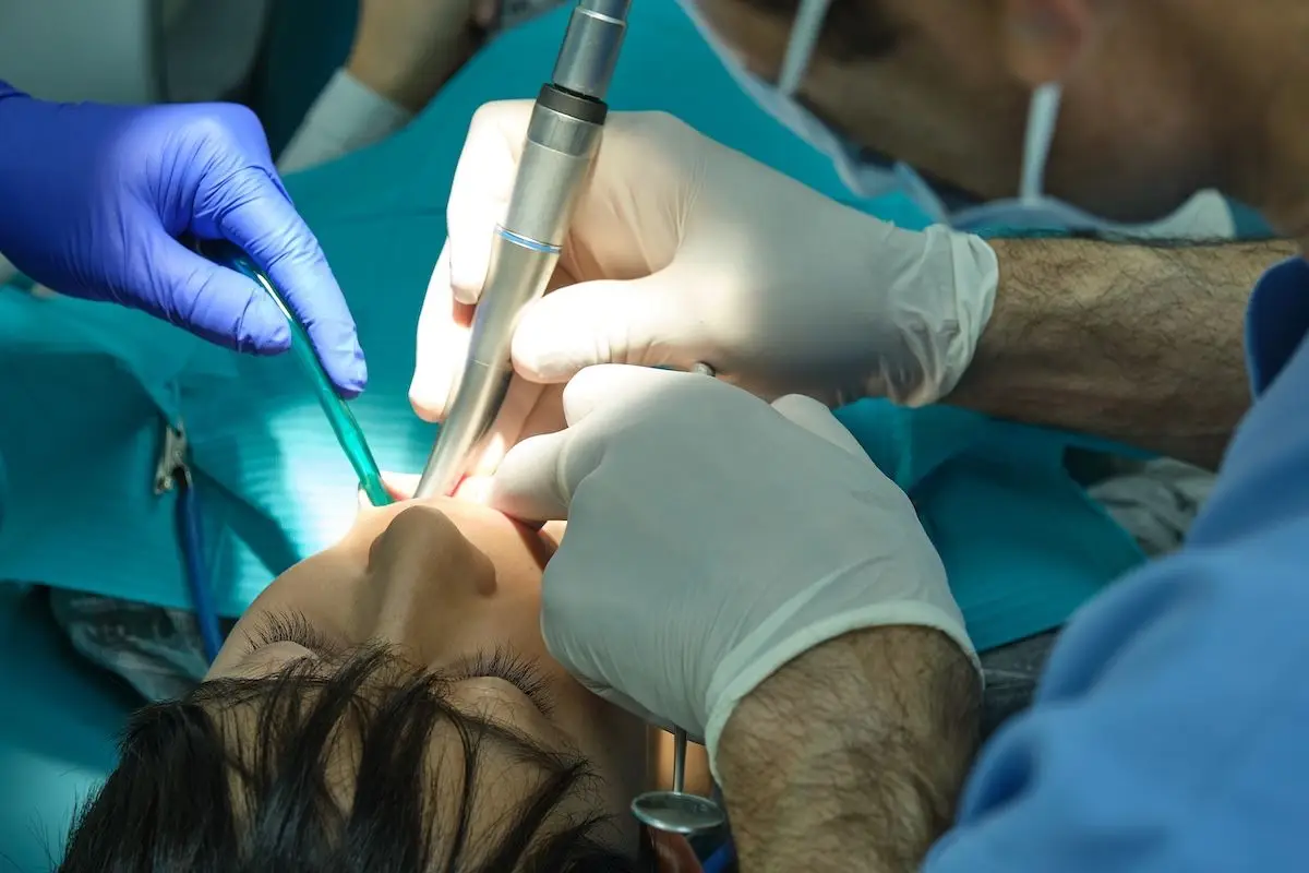 A young boy is lying back in a dental chair with his mouth open, undergoing a dental procedure. A dentist and an assistant are working on him, with the dentist holding a dental drill and the assistant using a suction device to keep the area clean. The dentist and assistant are both wearing gloves, and the boy appears calm, covered with a protective bib. The setting is well-lit, typical of a dental office.