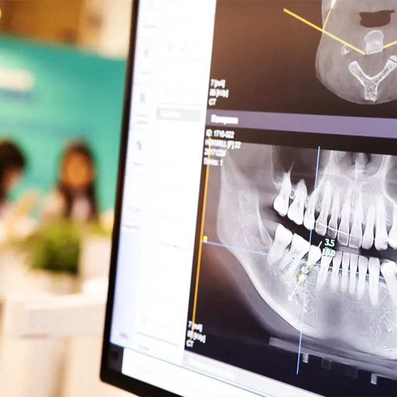 A monitor showing a panoramic dental X-ray in a dental clinic