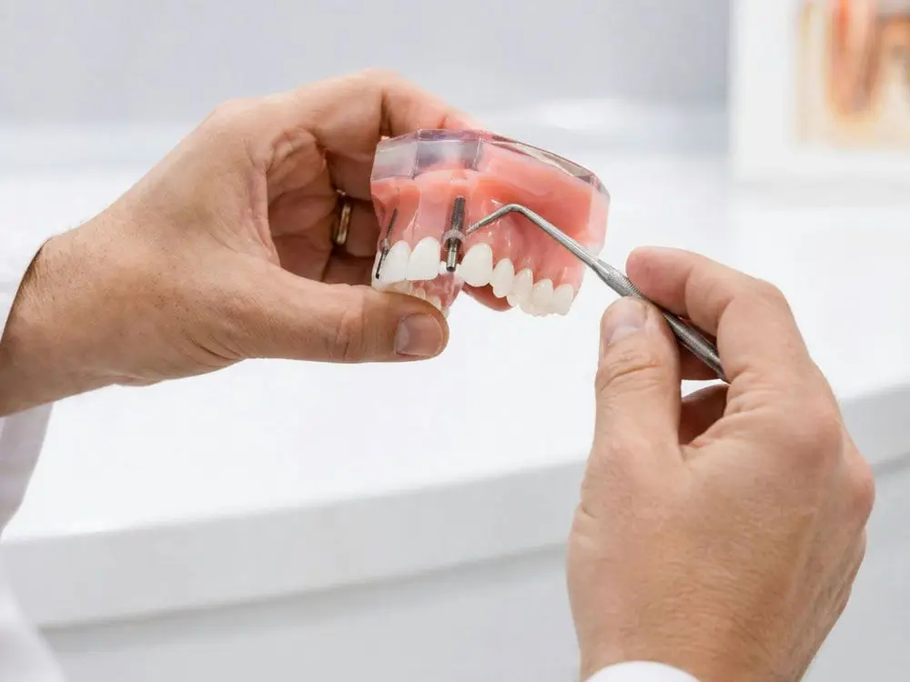 Dentist demonstrating dental implants on a model jaw.