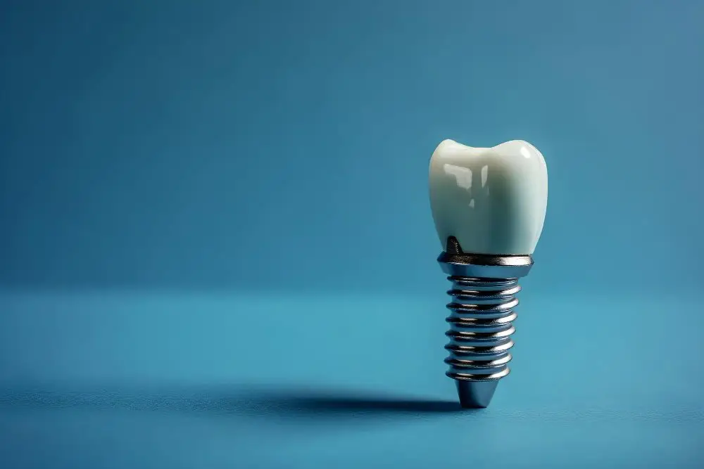 Longevity of All-on-4 Implants