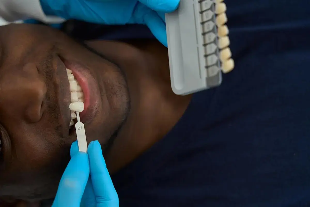 Dental patient smiling during tooth shade matching procedure, with dentist using blue gloves to hold shade guide marked 