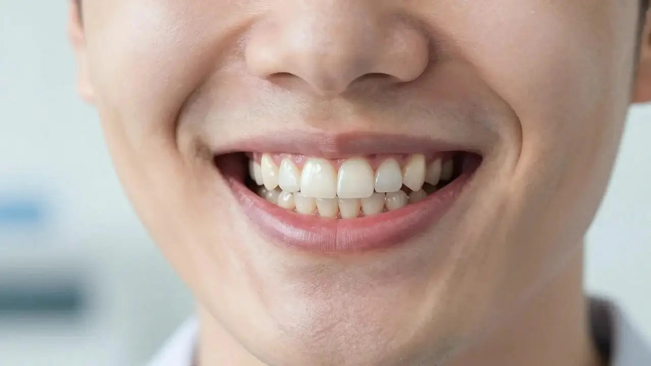 A close-up of a smiling person's teeth