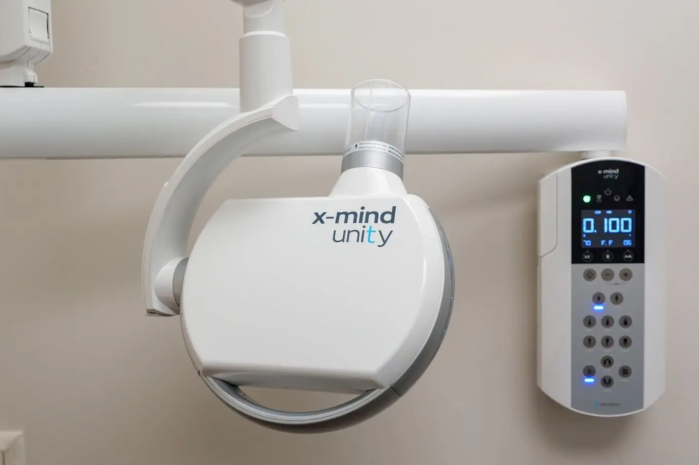 Close-up image of an X-Mind Unity digital dental X-ray machine mounted on a wall. The unit features a sleek white design with a digital control panel displaying settings. This state-of-the-art equipment ensures precise and safe dental imaging for accurate diagnosis.