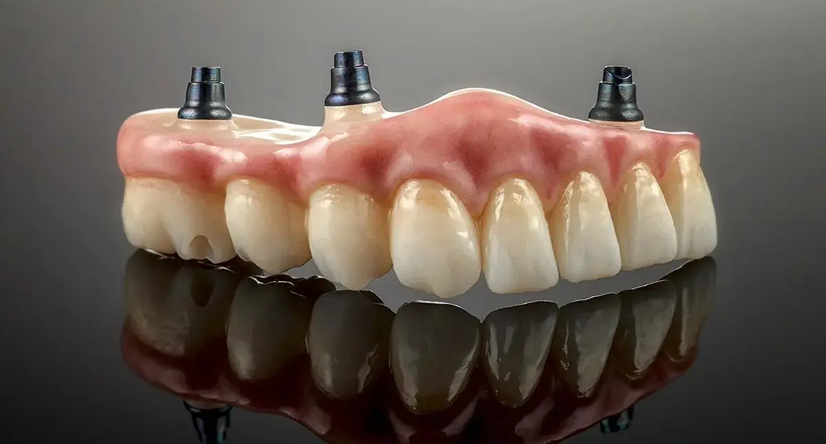 An implant-supported full-arch denture on a dark reflective surface