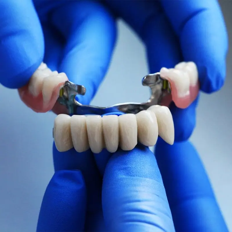 Gloved hands holding a partial denture with metal clasps